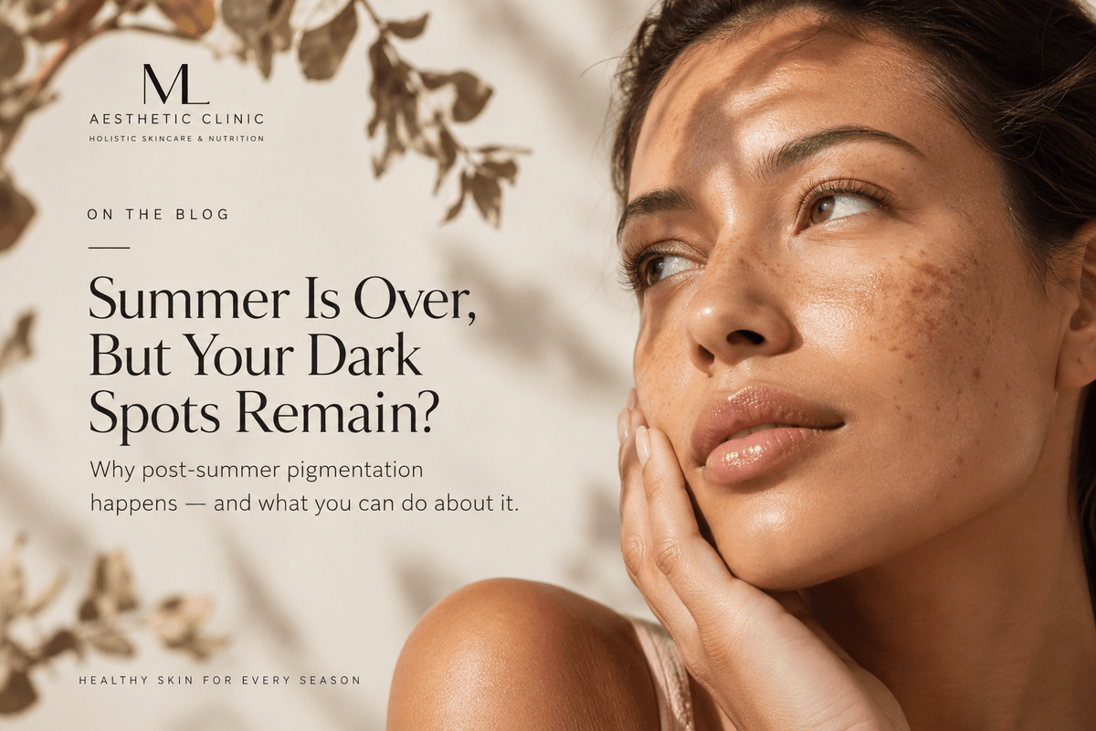 Summer Is Over, But Your Dark Spots Remain? | ML Aesthetic Clinic Montreal - ML Aesthetic Clinic